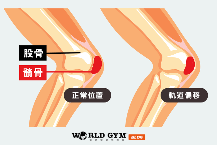 如何避免跑步膝盖痛？5种跑者常见伤害与预防方式